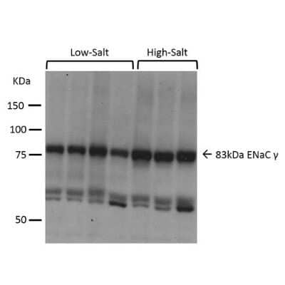 Western Blot epithelial Sodium Channel gamma Antibody